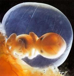 Embryo 7W_240